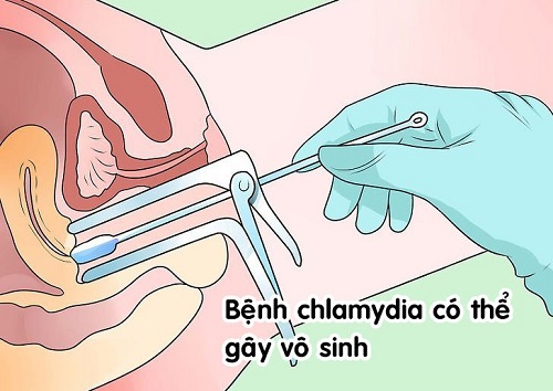 benh chlamydia